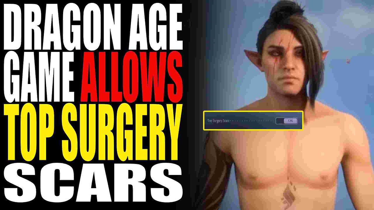 Dragon Age Customization For Top Surgery Scars