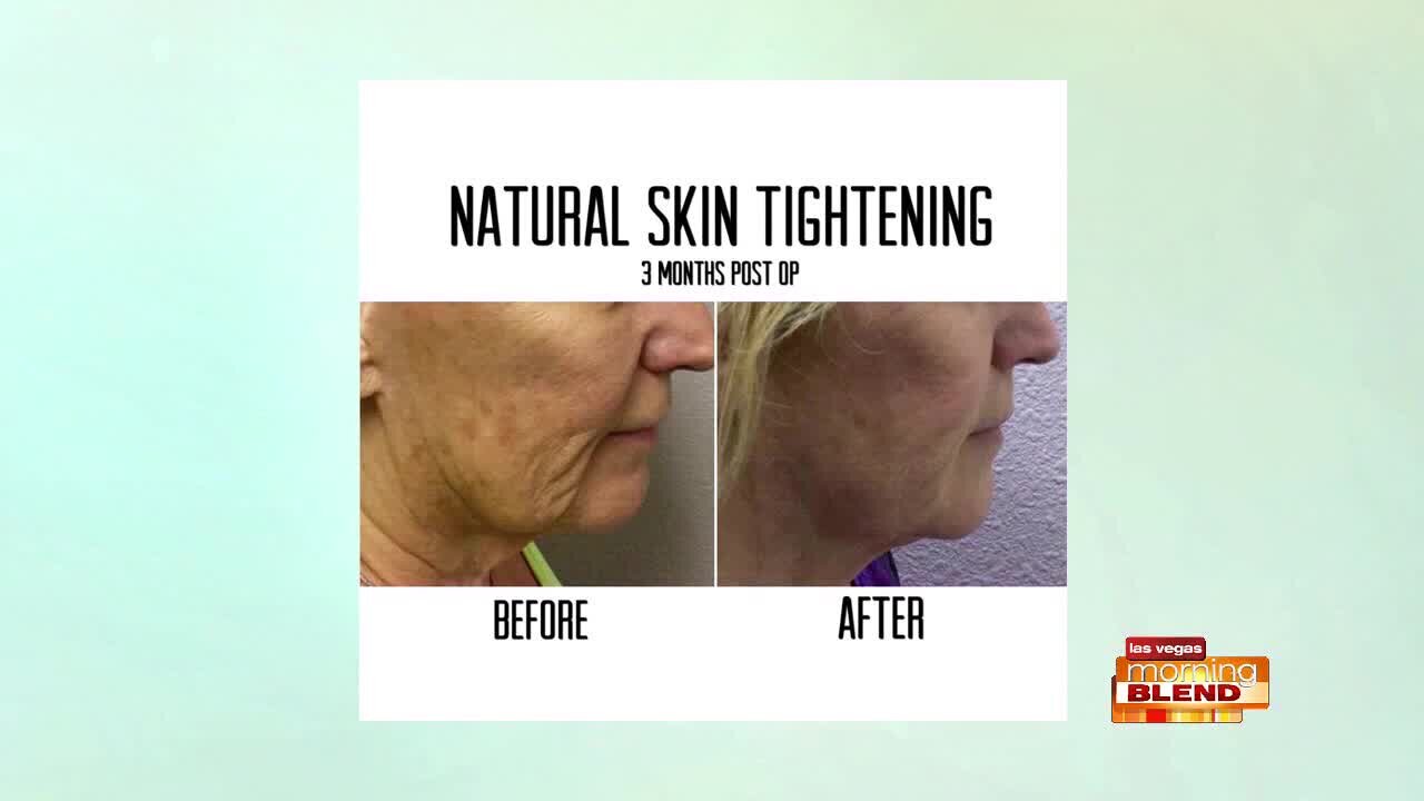 Tighten Sagging Skin