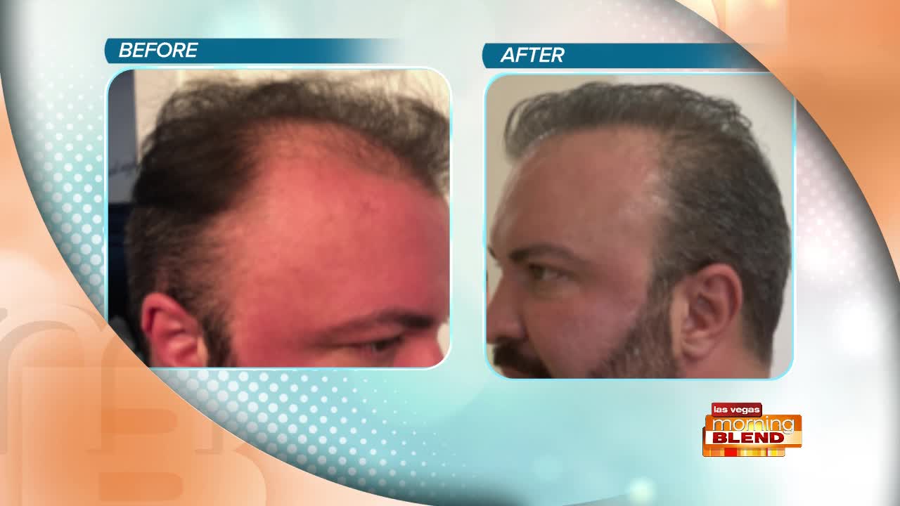 Rejuvenate Your Body And Health