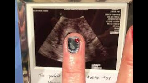 SCHOOL DENIES EMPLOYMENT TO THE VACCINATED CITING CONCERNS OVER SHEDDING