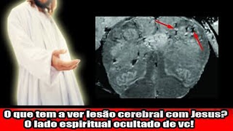 O que tem a ver lesão cerebral com Jesus! O lado espiritual ocultado de você