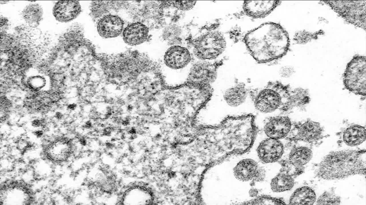 Colorado officials identify first known US case of COVID-19 variant seen in UK