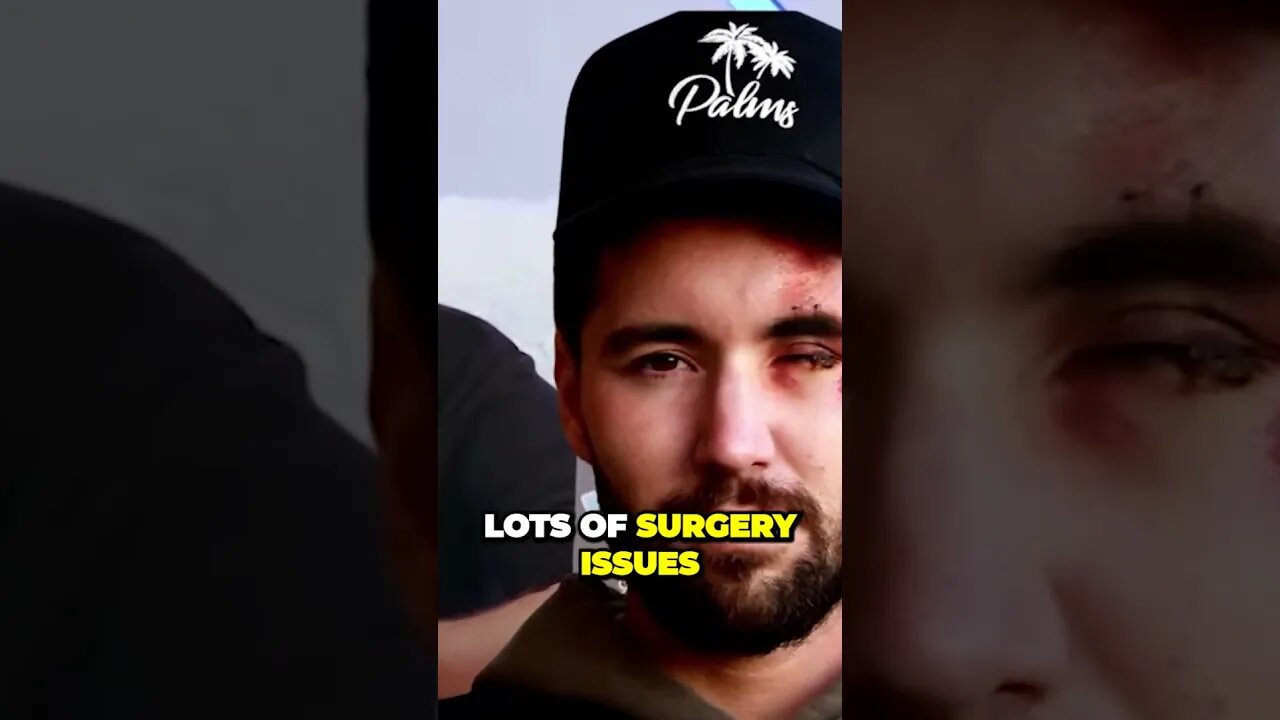 SHOCKING Betrayal David Dobriks Dangerous Stunt Reveals Friends Fate