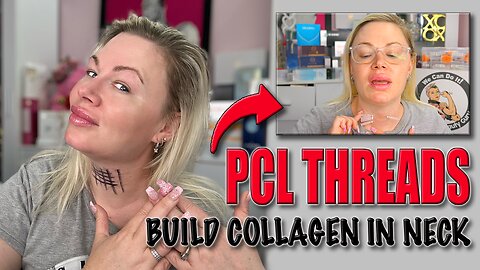 PCL Threads in Neck to Build Collagen! AceCosm, Code Jessica10 Saves you money