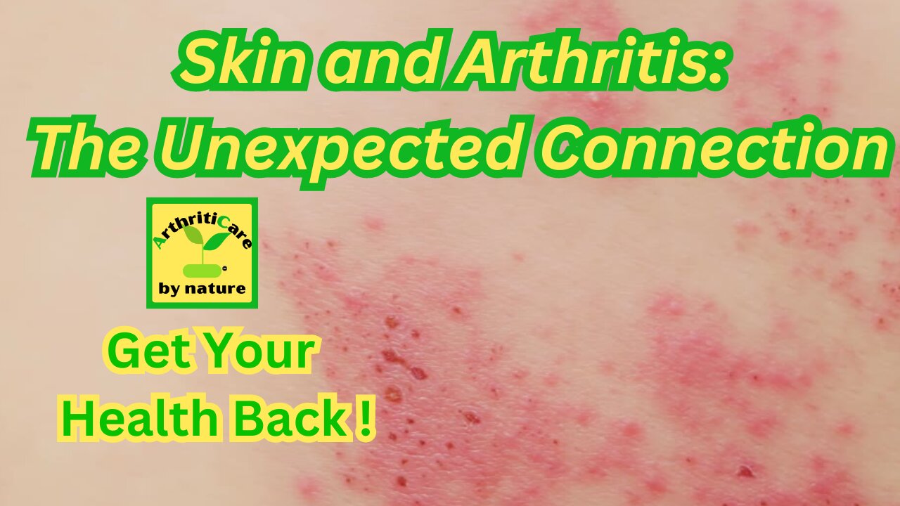 Skin and Arthritis: The Unexpected Connection - ArthritiCare