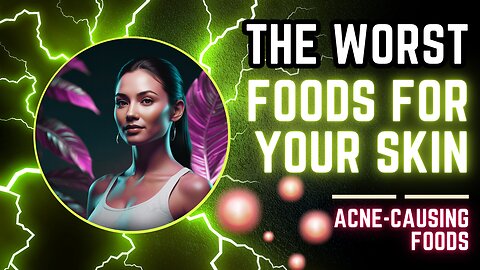 🔥The Worst Foods For Your Skin (Acne-Causing Foods) #health #wellness