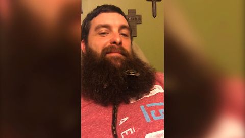 Pet Snake Makes Home In Man's Beard