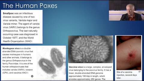 Dr. Chris Martenson - Monkeypox!!