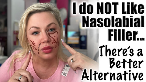 I Do NOT Like Nasolabial Filler .. There is a Better Alternative! Code Jessica10 Saves