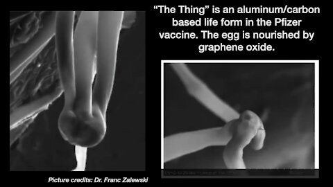 Four Deadly Parasites Found in the Jabs