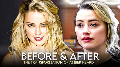 Amber Heard | Before & After | Plastic Surgery Transformation