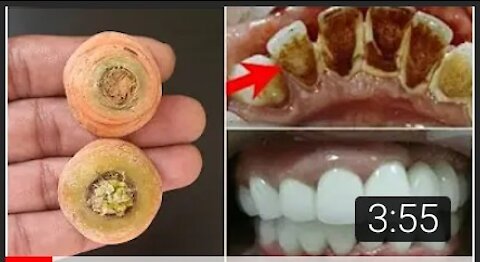 Teeth whitening Mojaraba minutes, yellow will make dirty teeth white like pearl and shiny