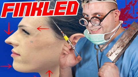 Transvestites Are Having Bone Surgeries To Look Like Ugly Women