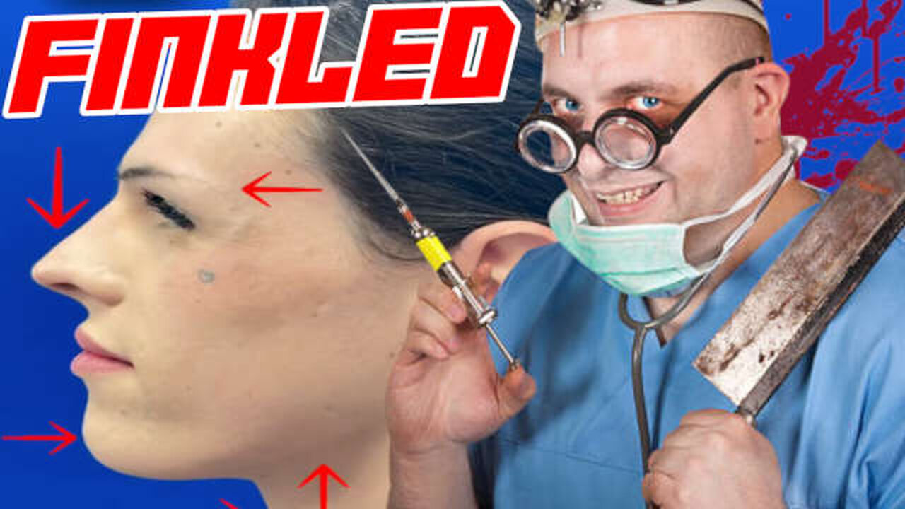 Transvestites Are Having Bone Surgeries To Look Like Ugly Women
