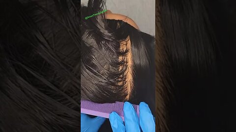 Scalp Check & Treatment ~ASMR No Talking #asmr #asmrsounds #anon7mousasmr #shorts