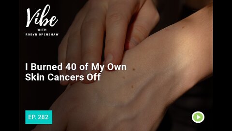 HOW I TREATED 40 SKIN CANCERS