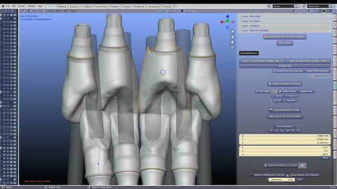 Opposing implant crowns