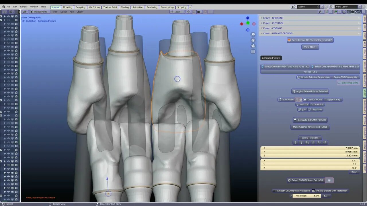 Opposing implant crowns