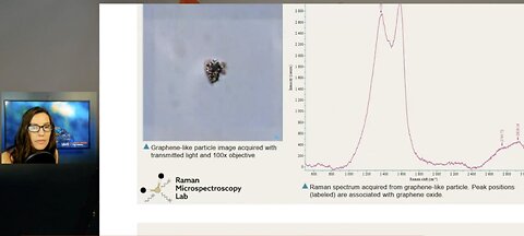 Confirmation By Scientists: Graphene Oxide Found In Dental Anesthetics