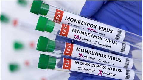 MONKEYPOX THE COVER STORY: In 2021 NTI predicts Monkeypox outbreak with 271 Million deaths.