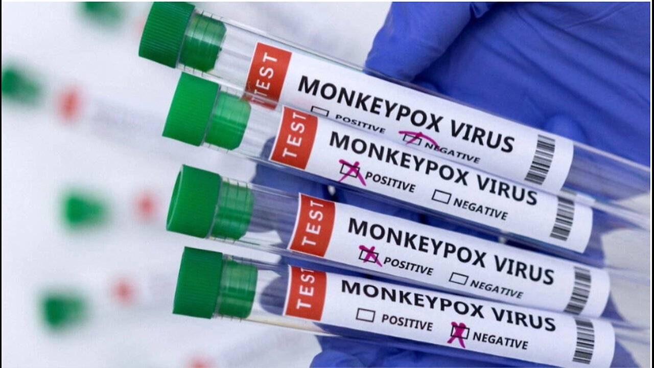 MONKEYPOX THE COVER STORY: In 2021 NTI predicts Monkeypox outbreak with 271 Million deaths.