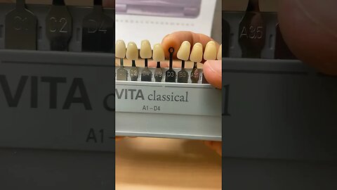 Easier Tooth Shade Match