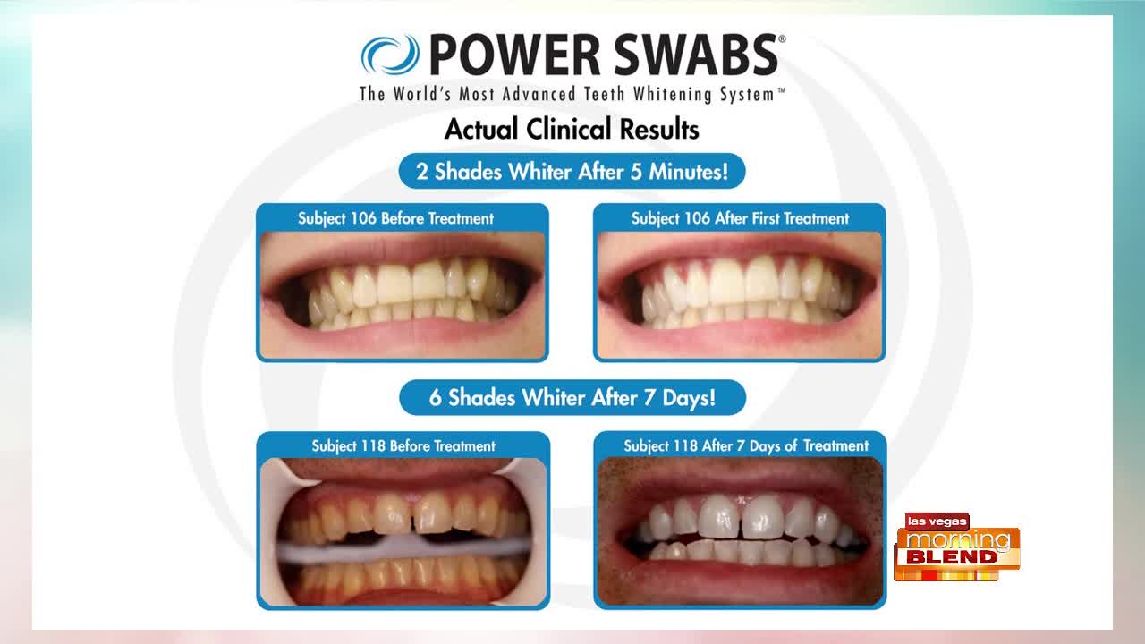 Get Cleaner, Whiter Teeth...Fast!