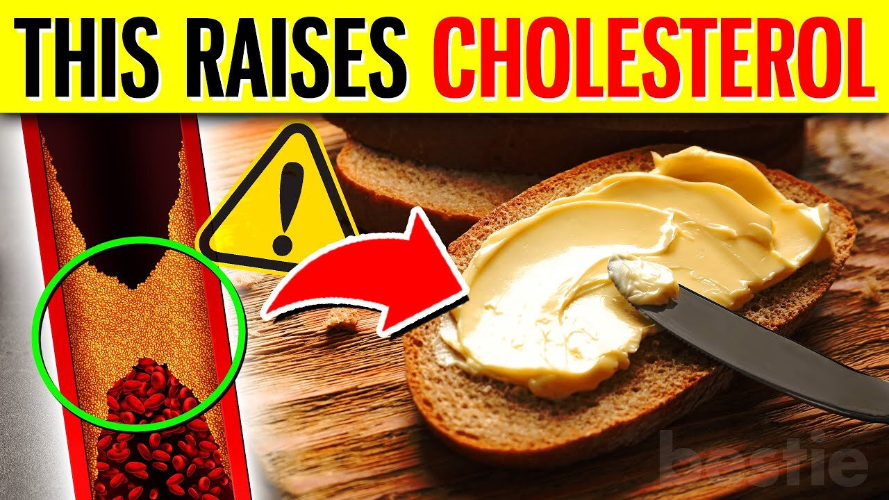 Top 10 Foods That INCREASE Cholesterol You Must Avoid