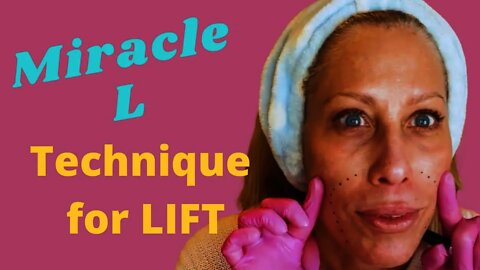Liquid Facelift Lifting Technique