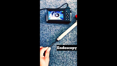 Mini Endoscopy