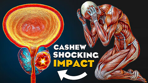 When You Eat 10 Cashew Nuts Every Day, Here's What Happened to Your Body (it is BAD??)