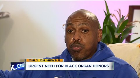 Organ donor pool needs more diversity, experts say