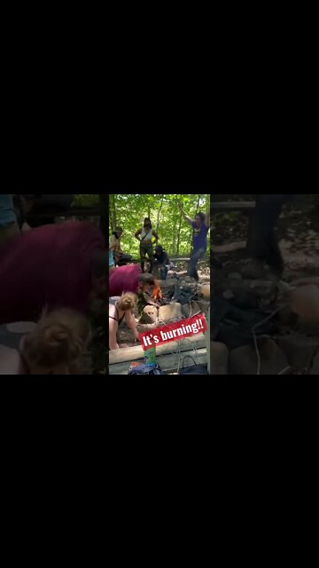 It’s Burning!! #shorts #college #outdoors #fire