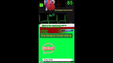 Third Degree Atrioventricular Block: heart, cardiology, atrioventricular block,MCQS