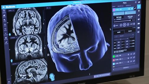 Alzheimer's Disease Awareness Month