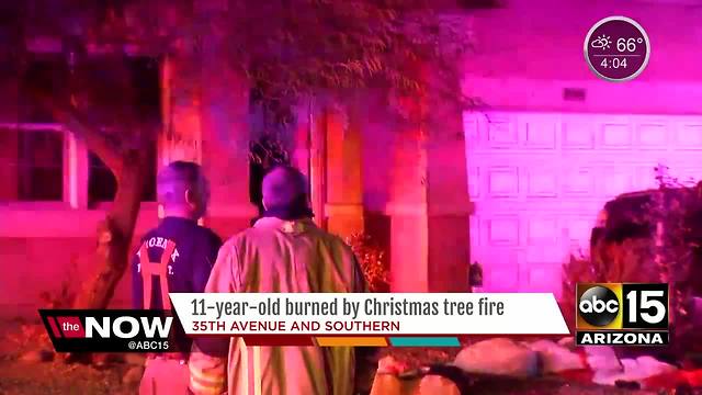 Phoenix child burned by Christmas tree fire