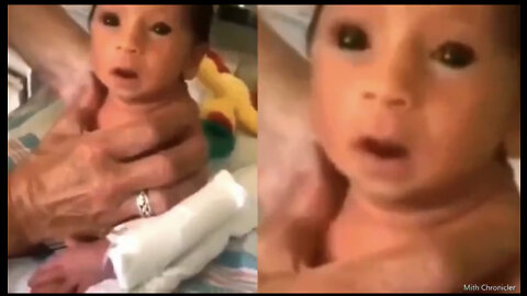 A Black Eyed Baby Compilation And Analysis