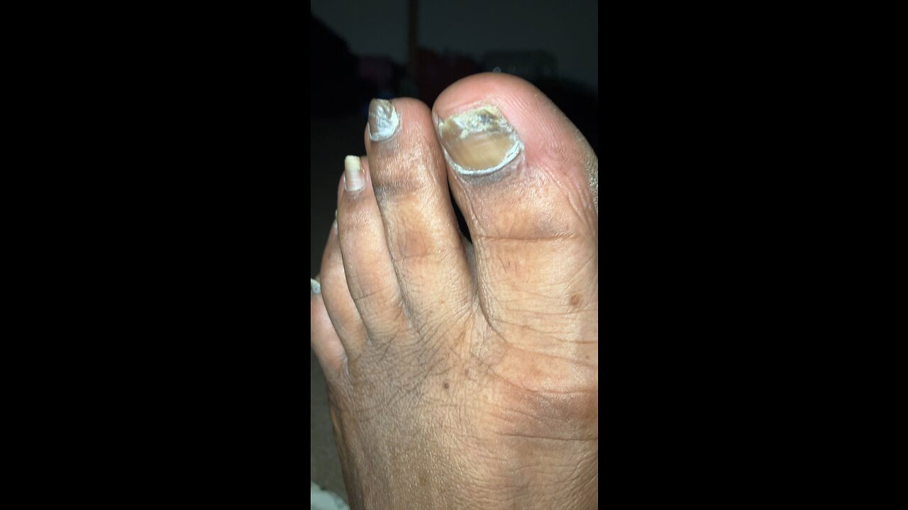 Salve Feet