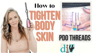 Stomach Skin Tightening: PDO Threads