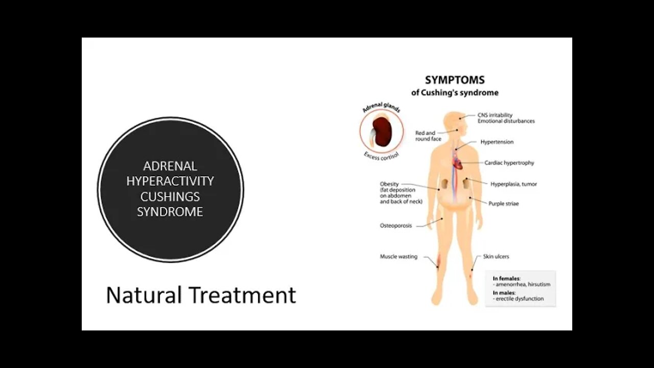 Adrenal Hyperactivity Cushing's Syndrome - Natural Treatment