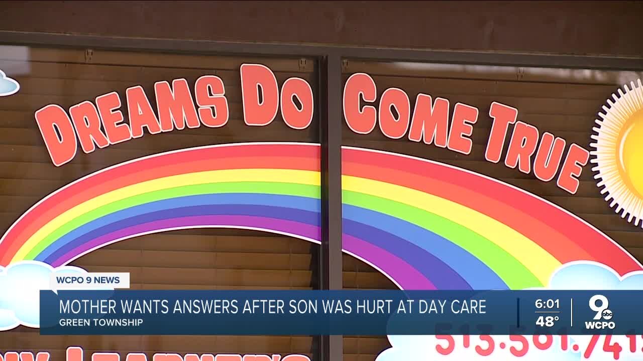 Mother claims daycare is negligent after unexplained bite, scratch marks on child