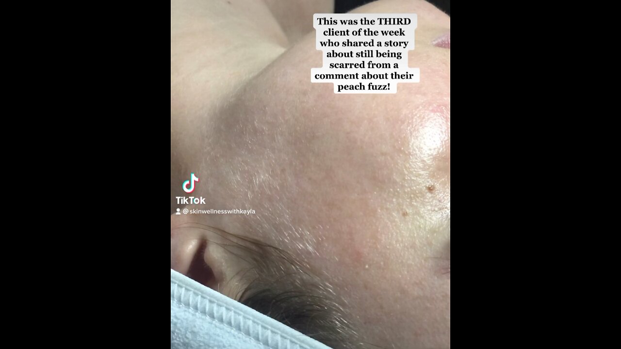 Dermaplane Facial