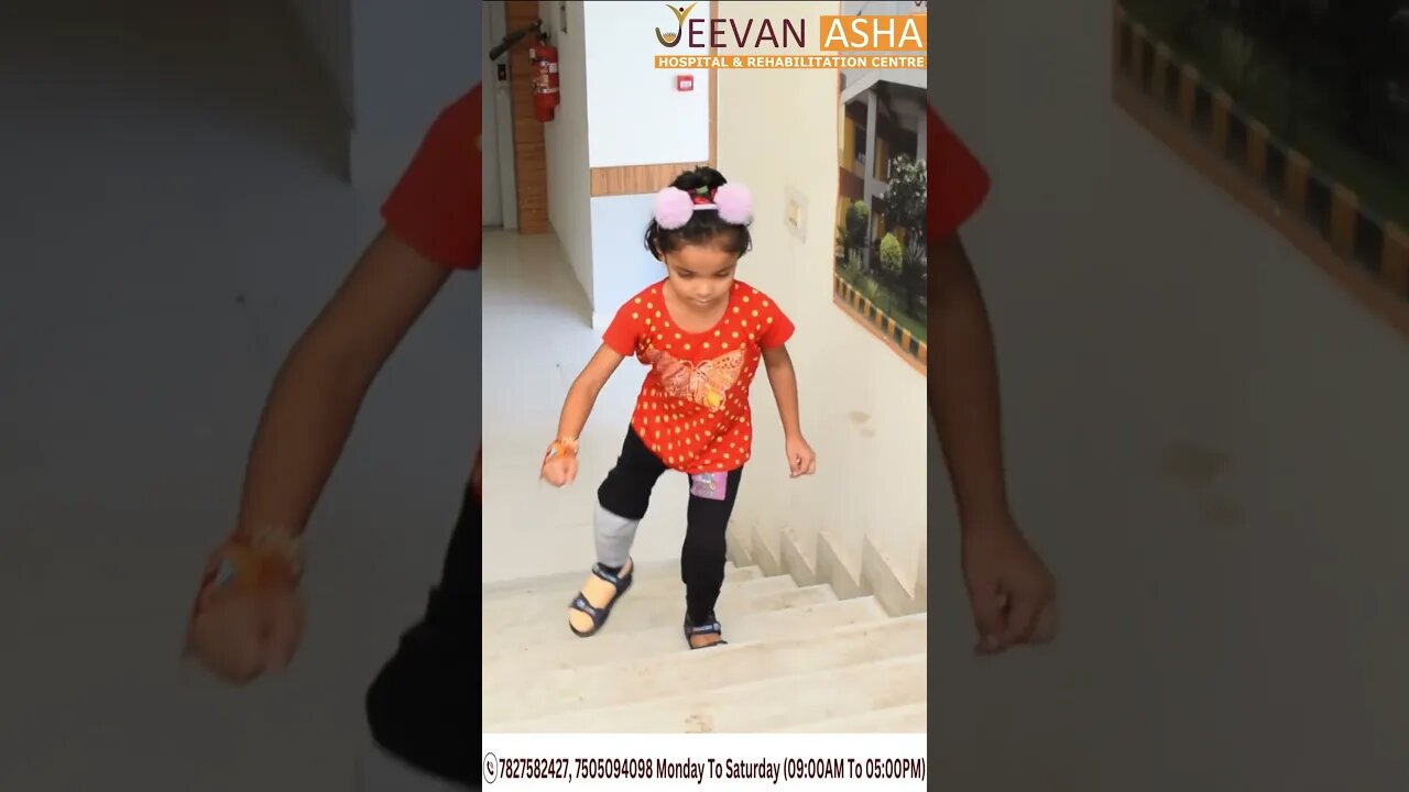 06 year's old Ritika lost a leg Jeevan Asha Hospital provided him #free of cost #modular #prosthesis