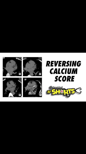 #SHORTS Reversing Calcium Score