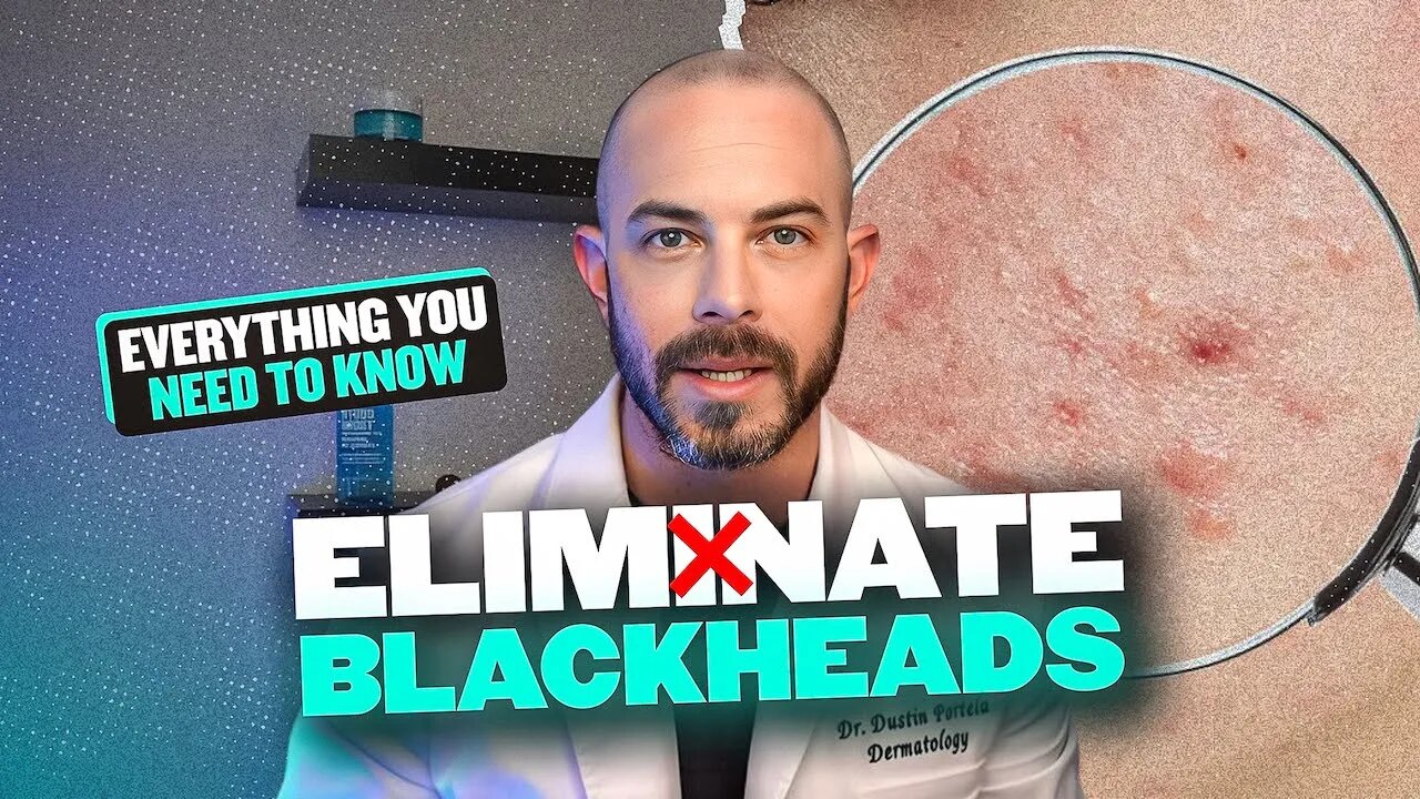 Blackheads & Whiteheads - How to Get Clear Skin According to a Derm