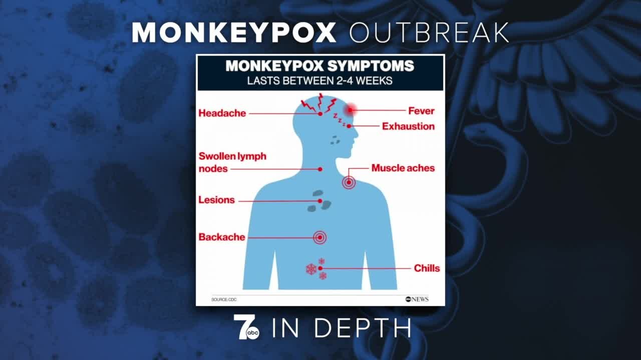 ECDOH: monkeypox detected in Erie County, risk to general public currently low