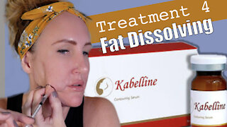 Fat Dissolving | Session 4 | Gorgeously Aging