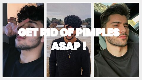 Get rid of acne and pimples in 7 days
