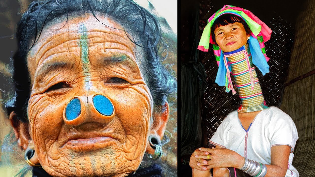 People With Rare and Unique Beauty Around the World