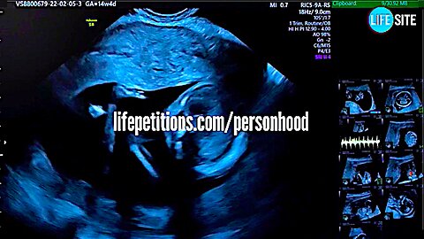 Jim Haven || We Need One (1) Million Names Against Abortion || Sign The Petition !!